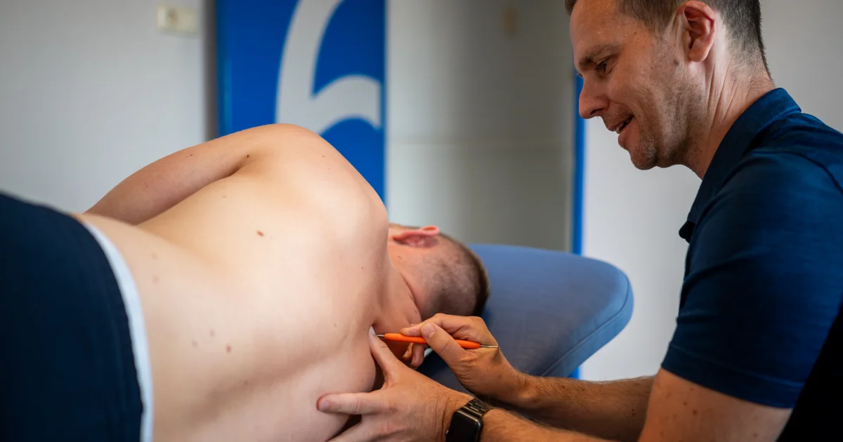 Dry needling in Heerlen:  spierpijn behandelen bij de Wijkel Groep